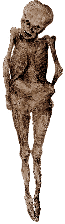 Extracted from Body of boy found in vault under St Botolph Aldgate, 1742. Reproduced by kind permission of Guildhall Library,  Corporation of London and available from COLLAGE at http://collage.cityoflondon.gov.uk